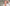 Quels sont les effets du collagène sur le visage ?